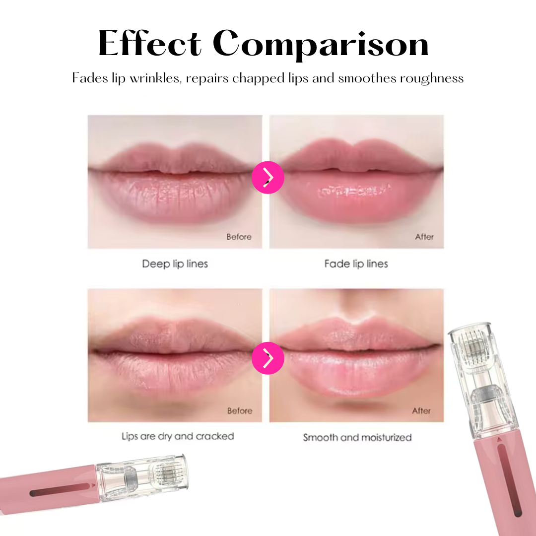 Lip Care