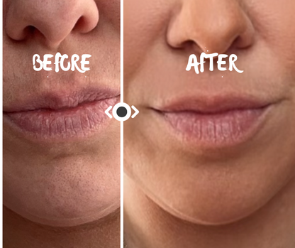 The Lip Boost Roller