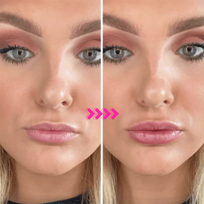 The Lip Boost Roller